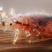 Pediculus humanus capitis