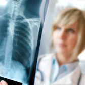 Female doctor examining an x-ray